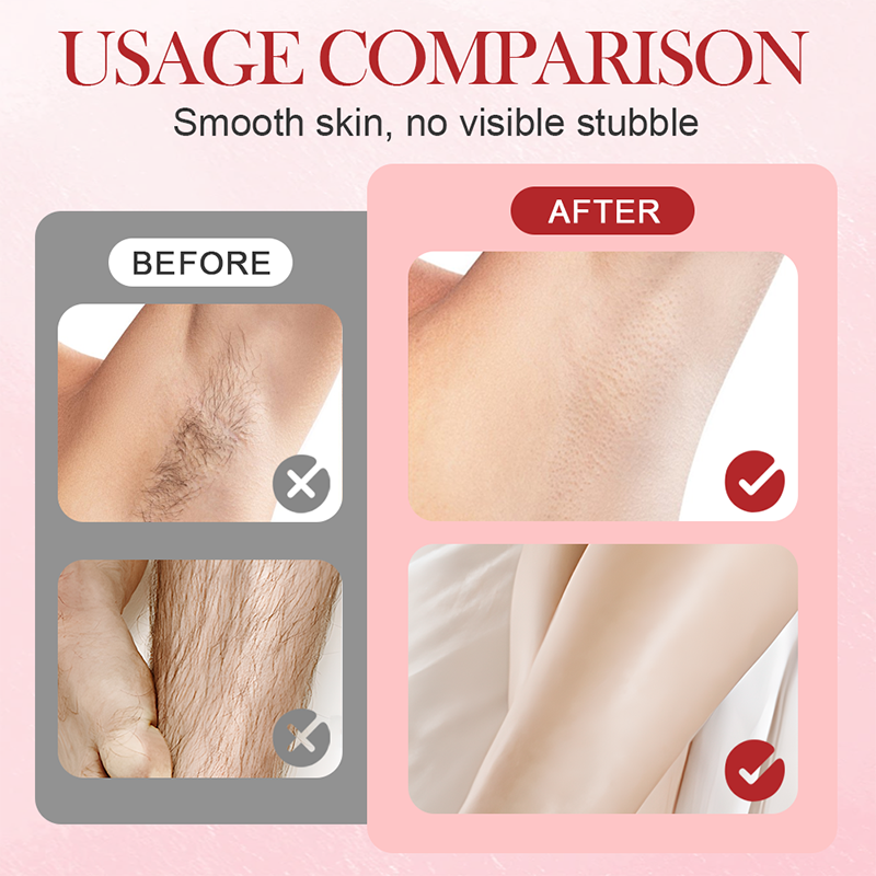Deals-Portable Dual-Head Electric Epilator
